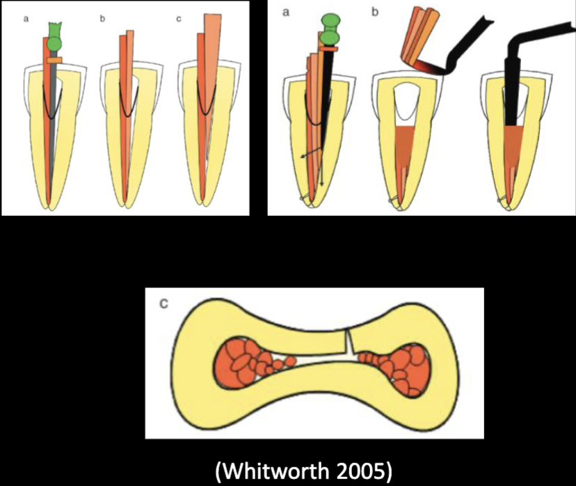 <p>advantages of lateral condensation (6)</p>