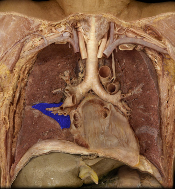 <p>remember its only on right lung</p>