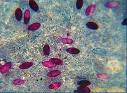 <p>Parasite and stain</p>