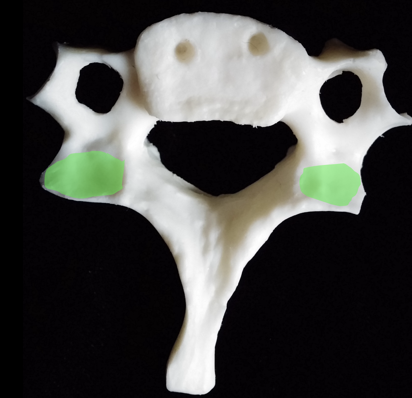 <p>From the inferior view, what is the green region highlighted on the C3-C7 cervical vertebrae?</p>