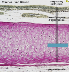 <p>Identify the type of cartilage</p>