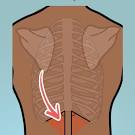 <p>What is CVA (Costovertebral angle) tenderness associated with? </p>