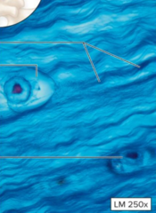 <p>-Parallel collagen fibers in matrix </p><p>-Can be found in intervertebral discs and the pubic symphysis</p>