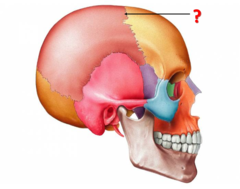 <p>Identify this structure.</p>