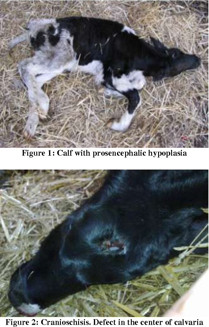 <p>PROSENCEPHALIC HYPOPLASIA</p>