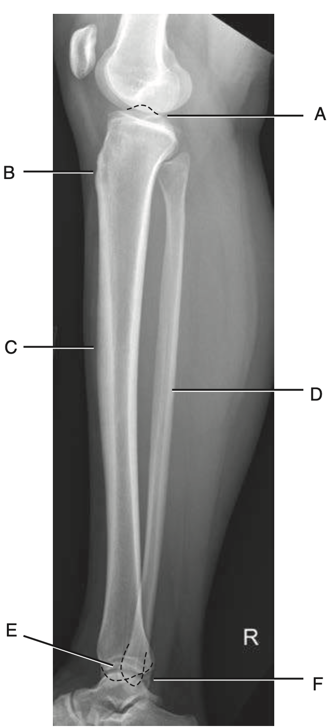 <p>C</p>