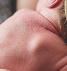<p>fine and unpigmented hair associated with embryological development</p>