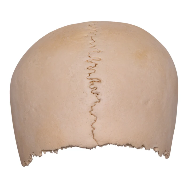<p>Cranial vault (calvarium)</p>