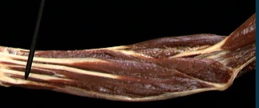 <p>Onder arm, aneteriore zicht</p>