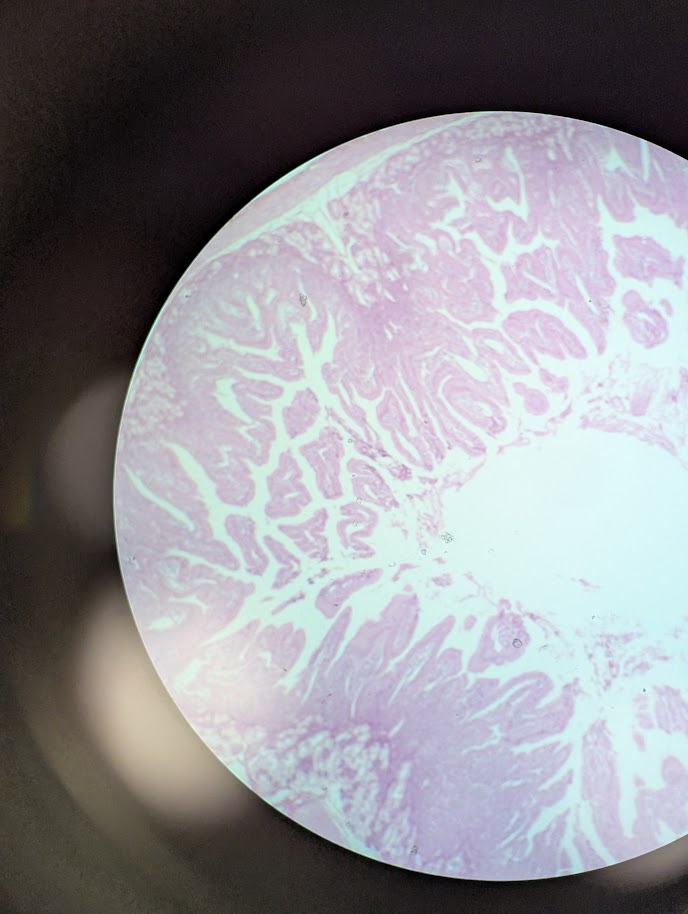 <p>Where in the body is this</p>