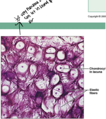 <p>What type of connective tissue is this?</p>