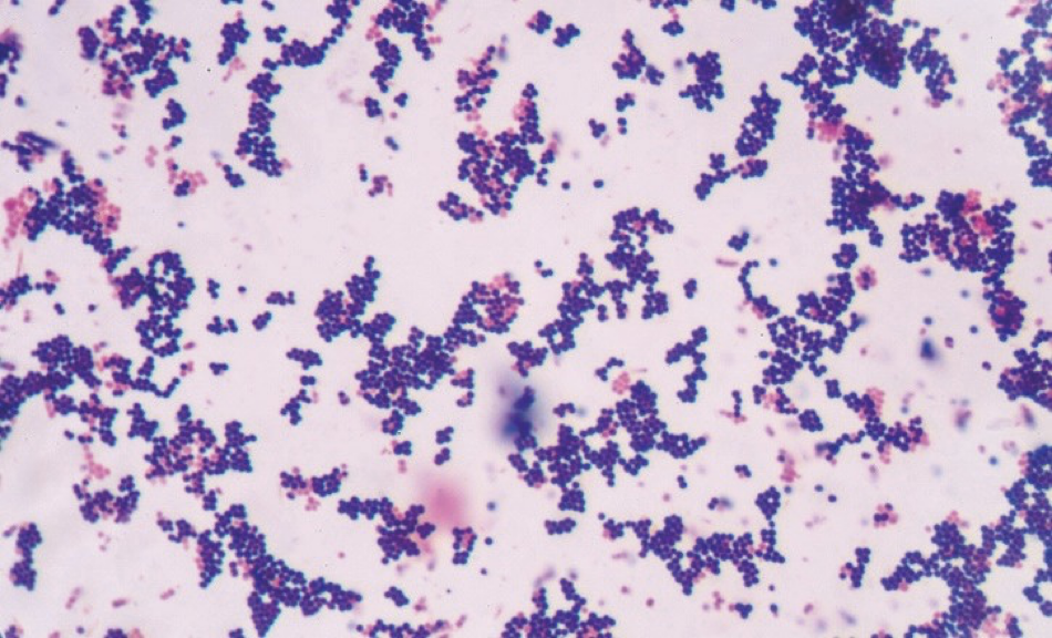 <p>What organism is this </p>