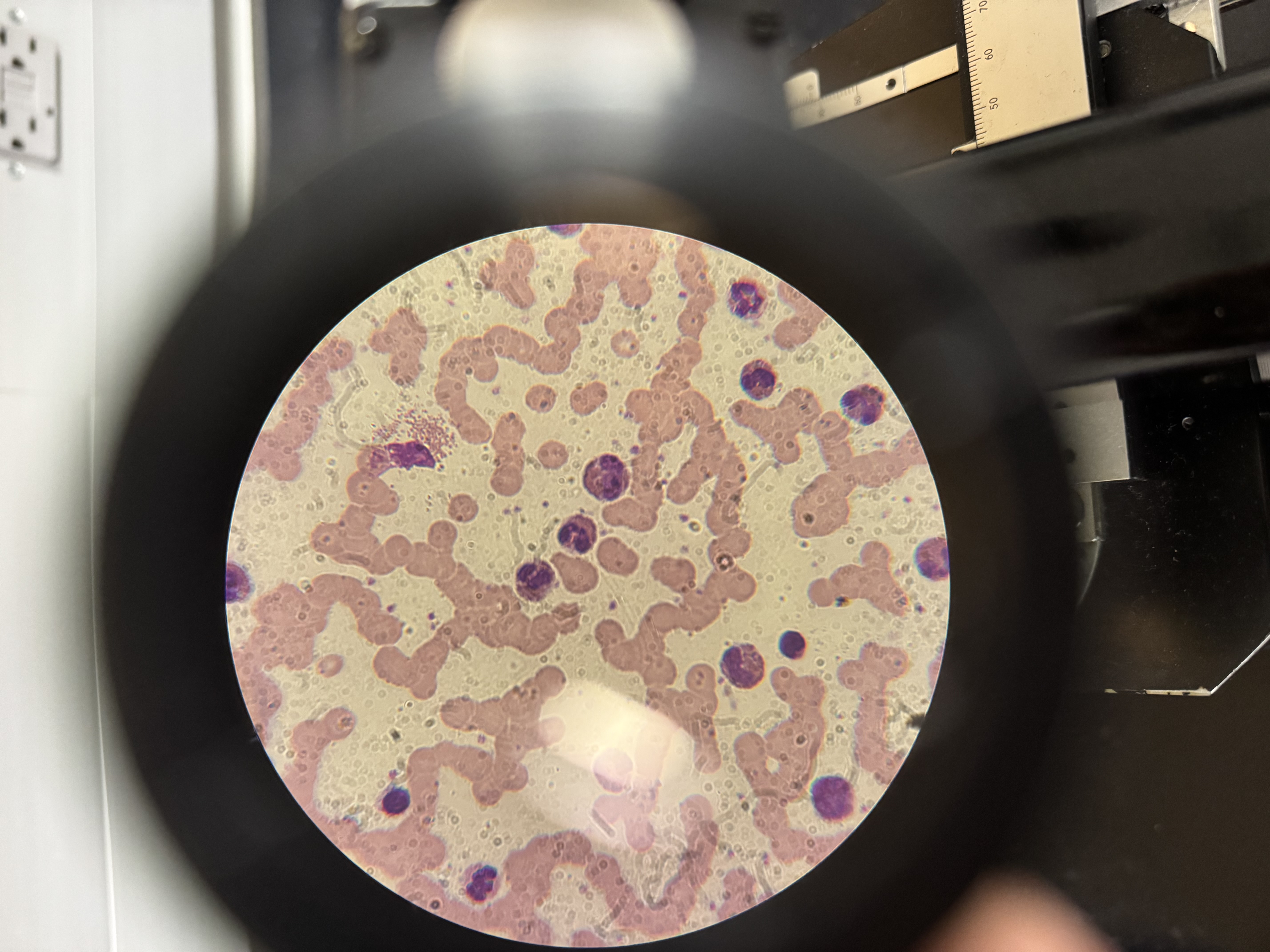 <p>a) Which WBC is this?</p><p>b) Describe the nucleus.</p><p>c) Granule color?</p><p>d) Function?</p>