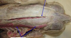 <p>What muscle are the bottom arrows pointing to?</p>