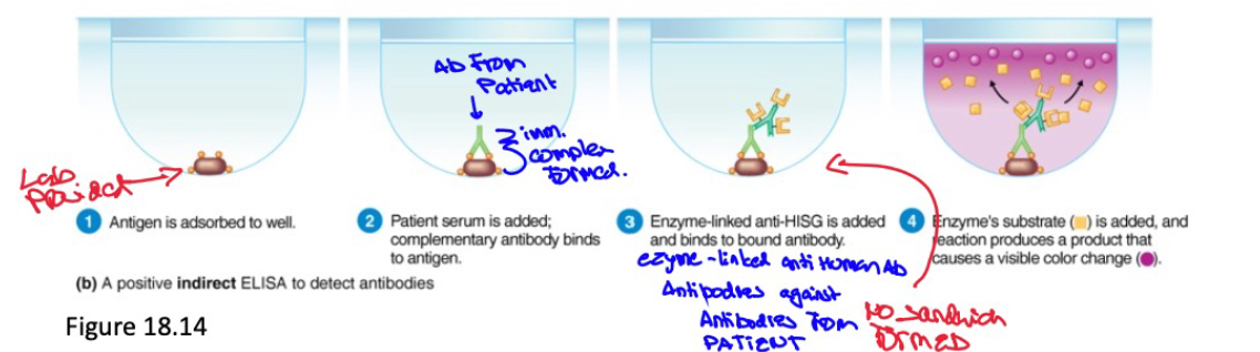 <ol><li><p>Antigen is attached to the well</p></li><li><p>Patient blood serum is added. Complimentary antibody binds to antigen</p></li><li><p>Enzyme linked anti human antibody (from the lab) is added → bind to bound antibody</p></li><li><p>enzyme substrate is added → causes a reaction → produces a product → cause visible color change (yellow → pink)</p></li></ol><p></p>