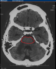<p>A brain structure that relays information from the cerebellum to the rest of the brain</p>