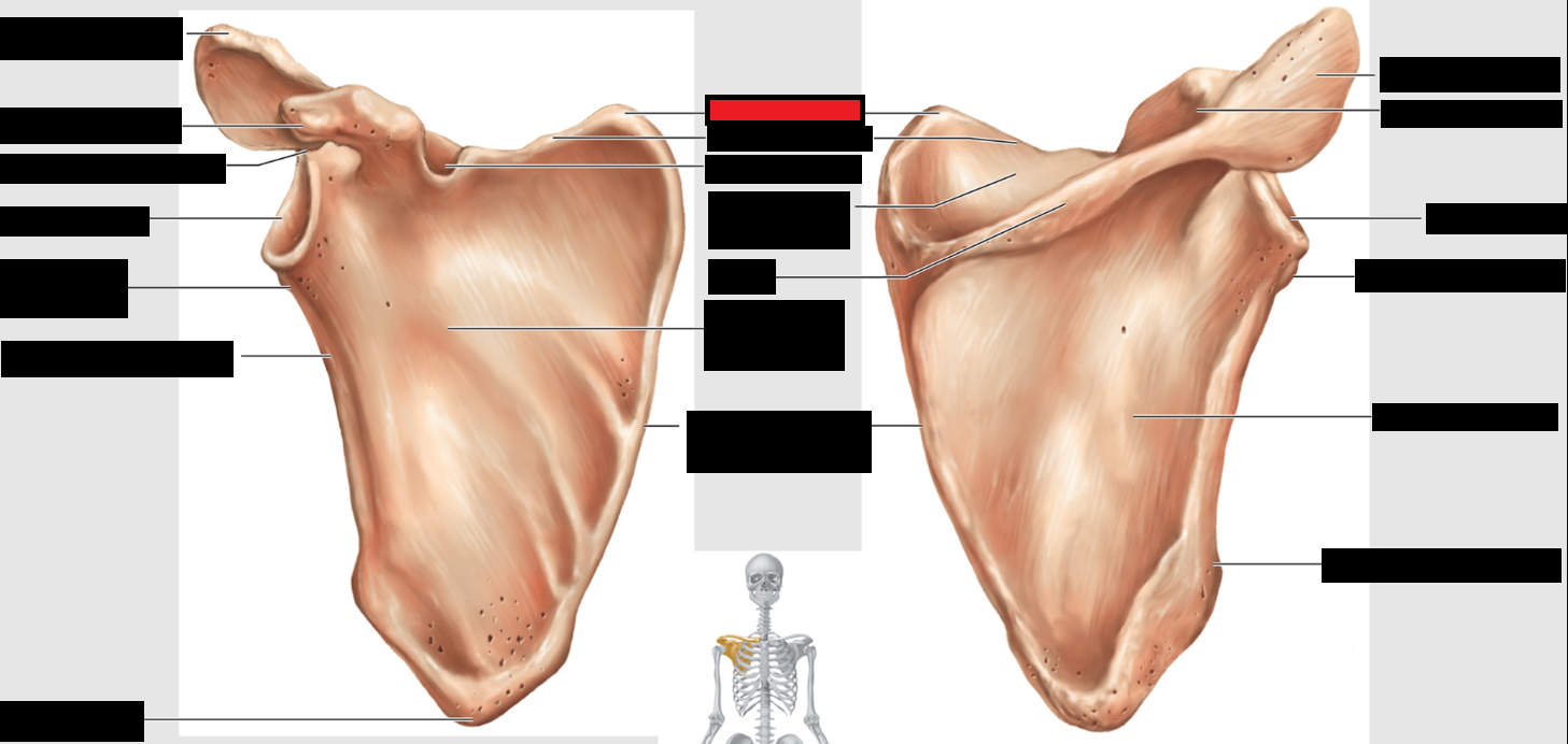 <p>Which part of the scapulae is this?</p>