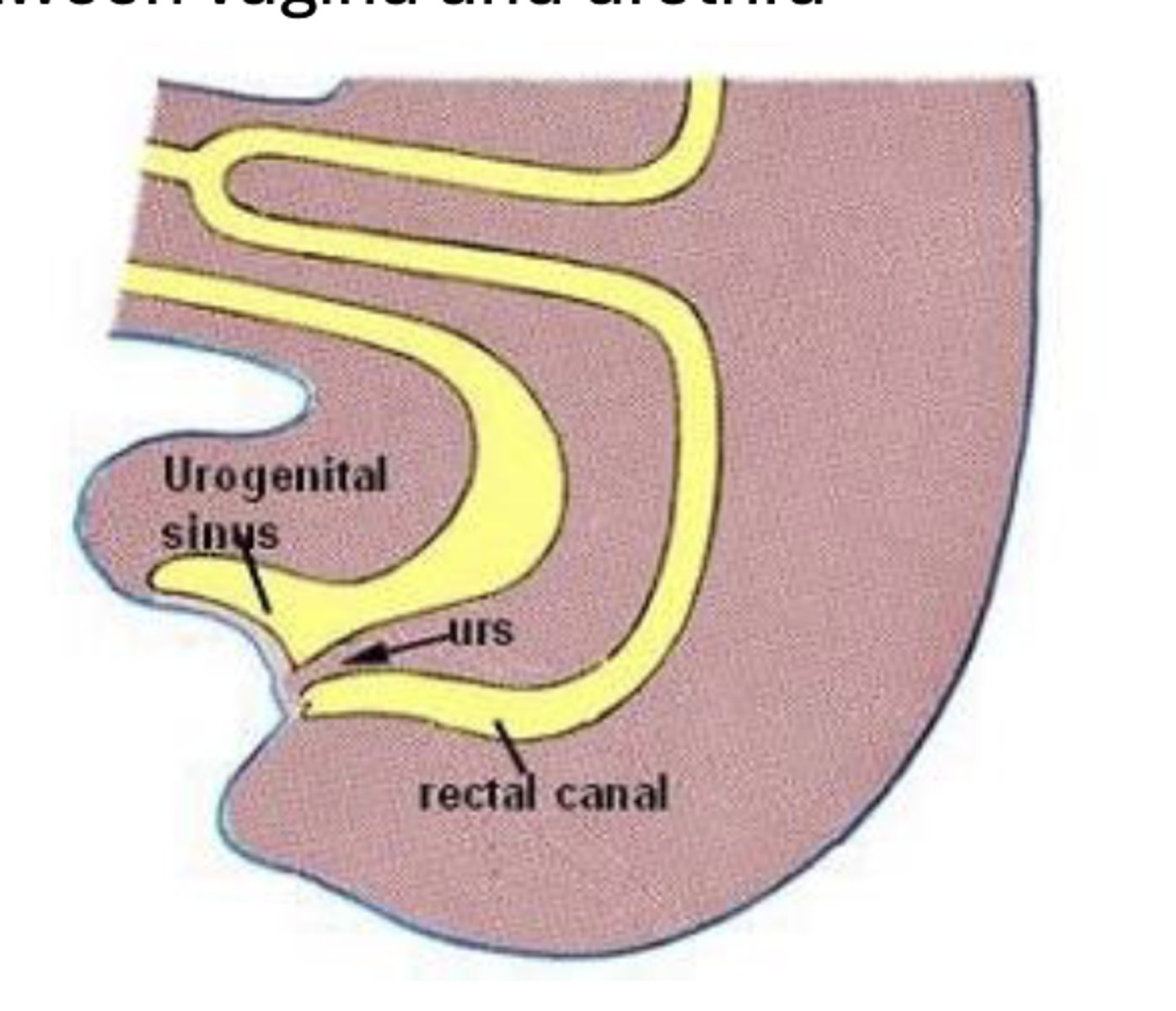 <p>• shared tube between vagina and urethra</p>