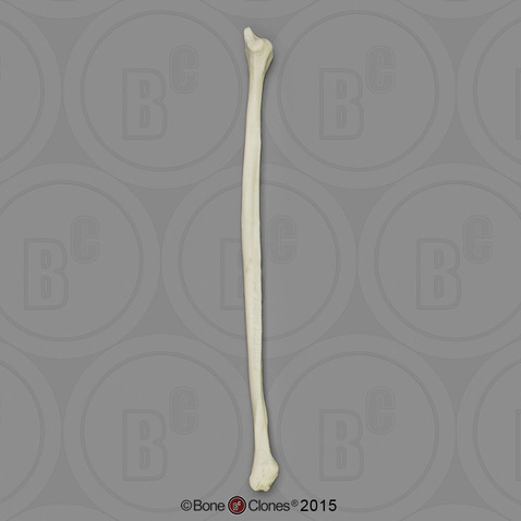 <p>What bone is this?</p>