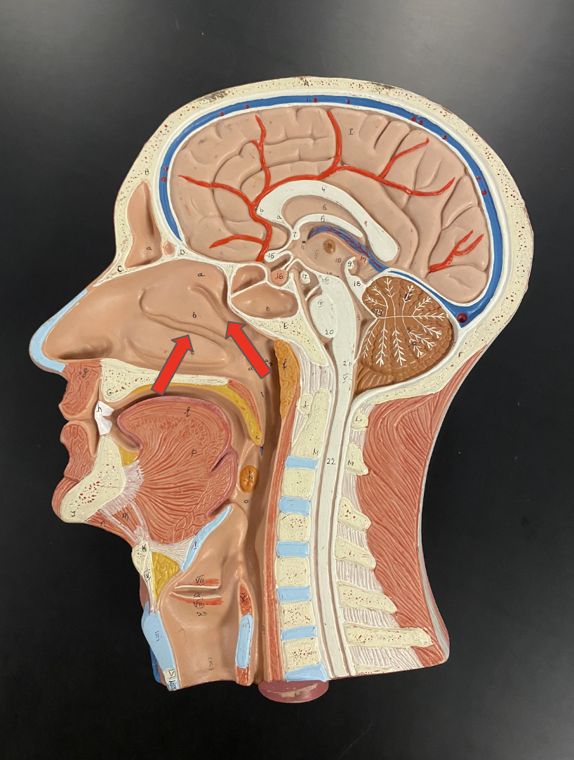 <p>Identify the structure</p>
