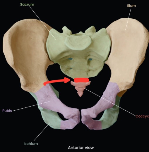term image