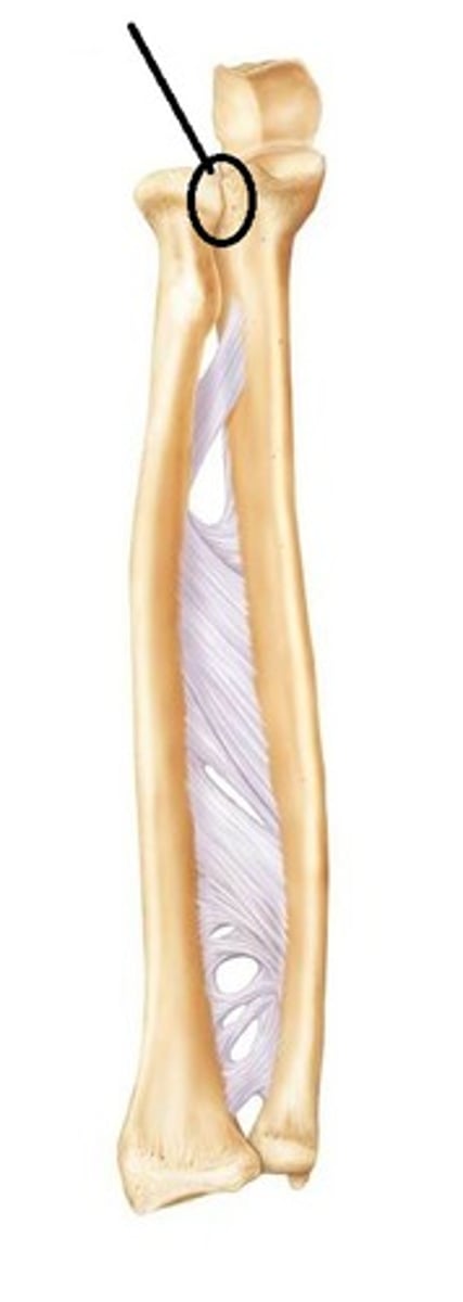 <p>What joint is shown?</p>