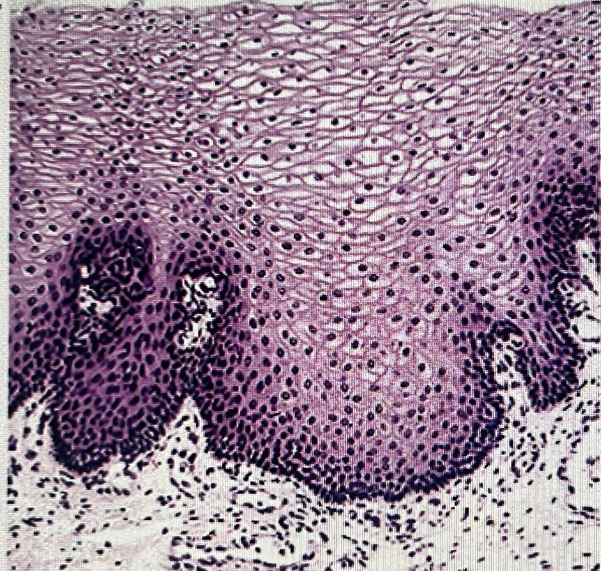 <p>Simple epithelial or stratified epithelial?</p>