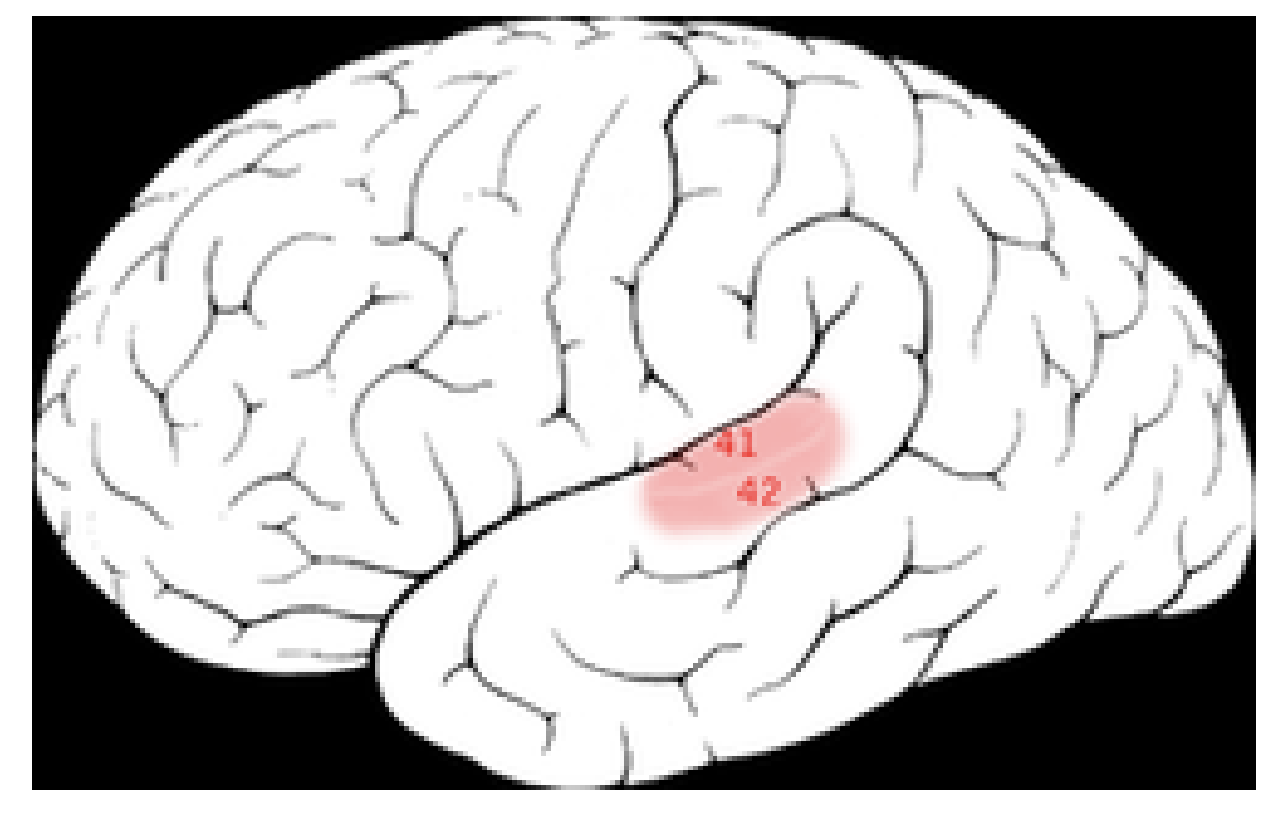 <p>• Auditory nerve exits IAC</p><p>• Ascending pathway to the</p><p>brain</p><p>• Same nuclei on both sides</p><p><span data-name="white_small_square" data-type="emoji">▫</span> Cochlear nucleus</p><p><span data-name="white_small_square" data-type="emoji">▫</span> Superior Olivary Complex</p><p><span data-name="white_small_square" data-type="emoji">▫</span> Lateral Lemniscus</p><p><span data-name="white_small_square" data-type="emoji">▫</span> Inferior Coliculus</p><p><span data-name="white_small_square" data-type="emoji">▫</span> Medial Geniculate</p><p>primary auditory cortex=herschels gyrus</p>