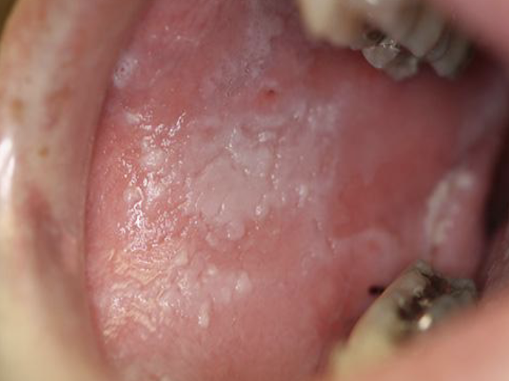 <p>Surface Texture : wrinkled </p>