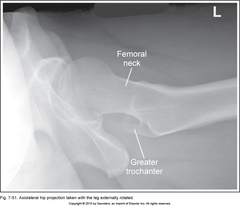 <p>hip axiolateral (danelius-miller/x-table)</p>
