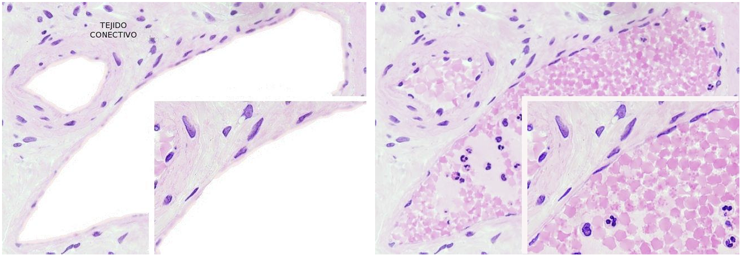 <p>Simple Squamous Epithelium in the Circu Sys is called what? </p>