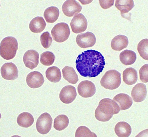 <p><span>even rarer leukocyte with a purple nucleus and large, dark granules</span></p><p class="s13"><span>○Named for the basic stain that works best</span></p><p class="s13"><span>○Granules are large and dark blue and may block out the nucleus.</span></p><p class="s13"><span>Associated with histamines(allergens)</span></p>