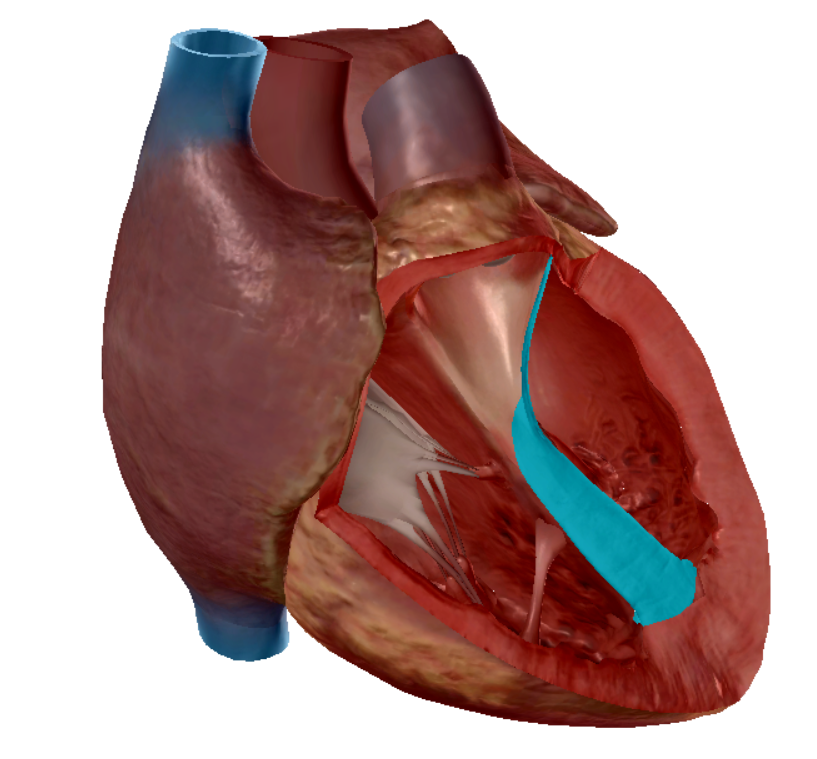 term image