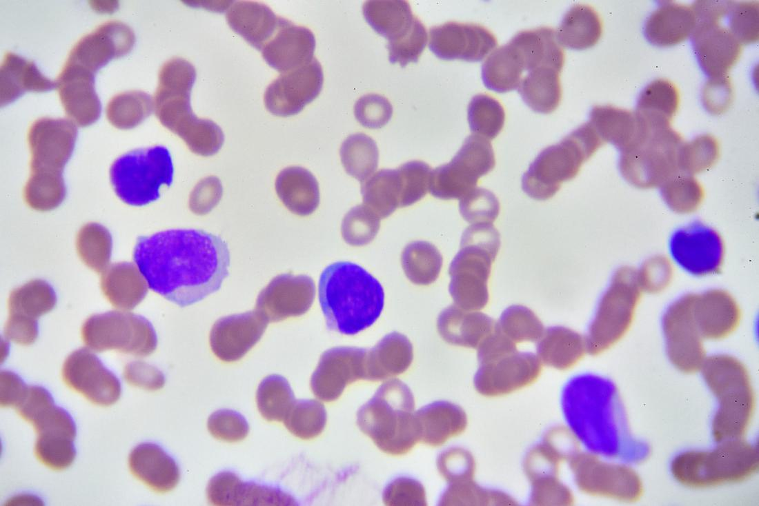 <p>high basophils</p><p><strong><mark data-color="rgba(0, 0, 0, 0)" style="background-color: rgba(0, 0, 0, 0); color: inherit;">often indicate that your immune system is responding to an allergen, infection, or chronic inflammation</mark></strong><span>.</span></p>