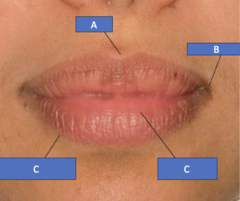 <p>What is A?</p>