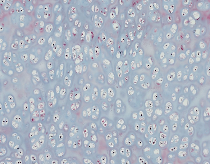 <p><span style="font-family: "Calibri Light";">1. Which basic type of CT is this?<br><br>2. Can you be more specific?</span></p>