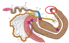 <p>the pelvic flexure because it is easily exteriorized and can be placed on an operating tray to minimize contamination of the abdomen during surgery</p>