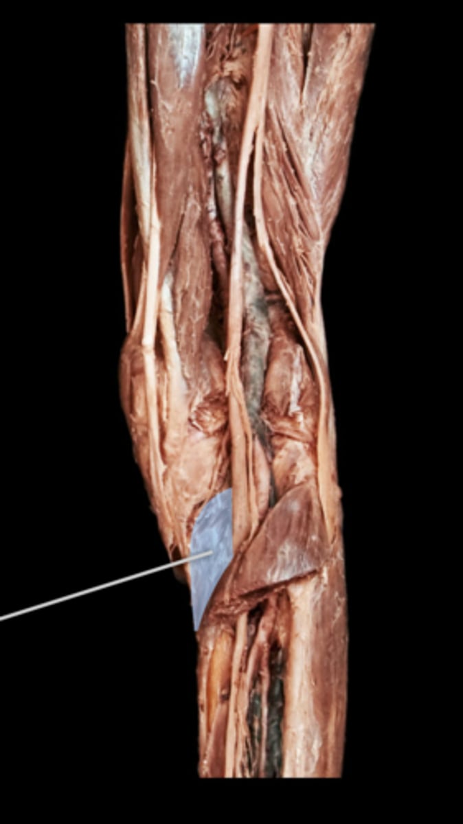 <p>What muscle is this?</p>
