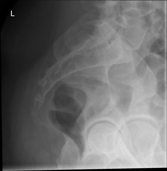 <p>critique this sacrum lateral</p>