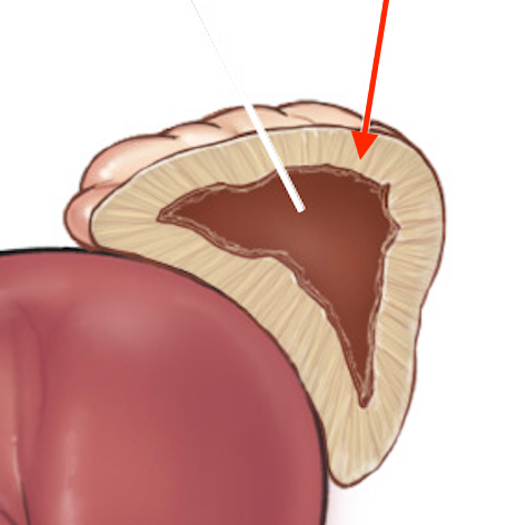 <p>outer adrenal gland</p>