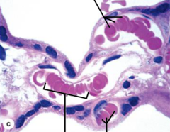 <p>What cell type is being pointed out here?</p>