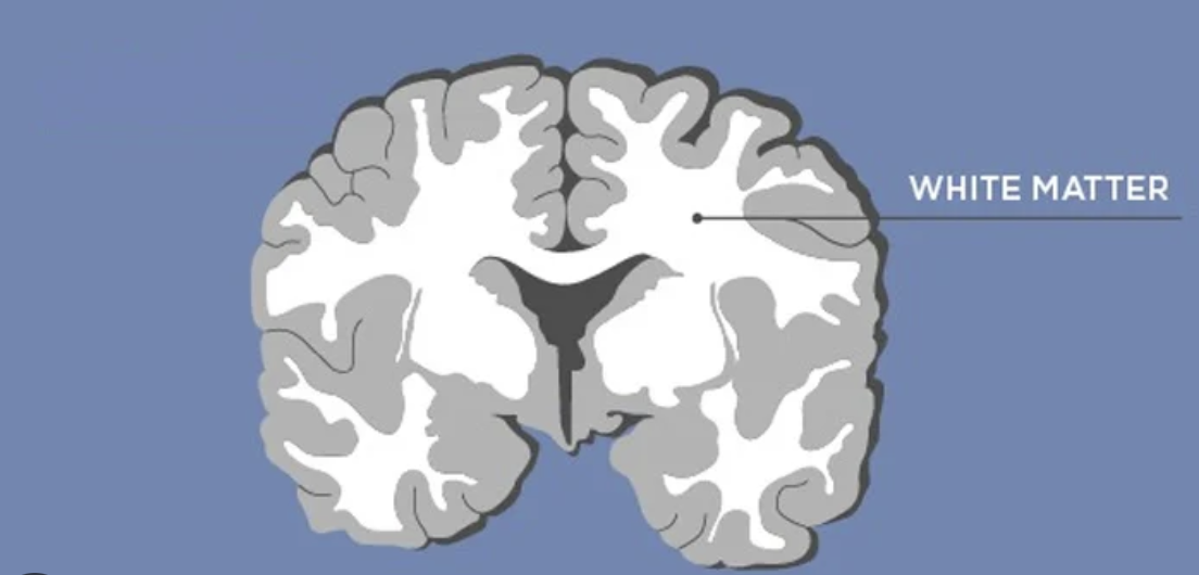 <p><strong>white matter</strong>→myelinated axons</p><p><strong>grey matter</strong>→unmyelinated, mostly dendrites, & neuron cell bodies </p>