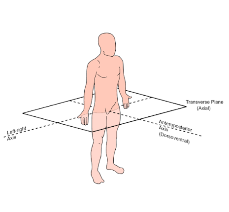 <p>Horizontal split superior + inferior halves</p>