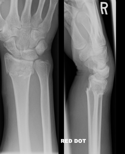 <p>What is the diagnosis?</p>