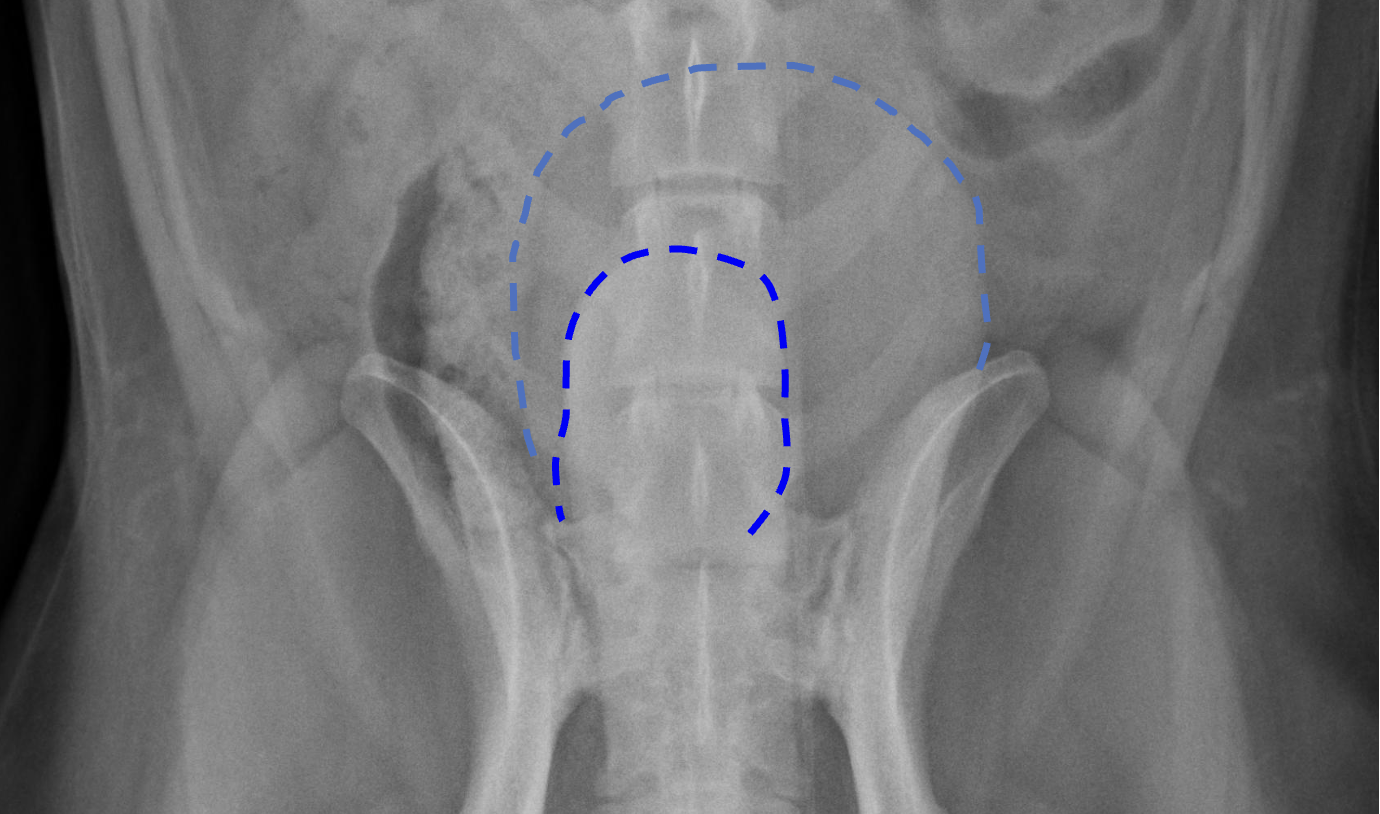 <p>What structure is outlined in darker blue?</p>