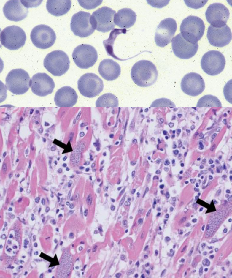 <p>How is <em>Trypanosoma cruzi</em> infection diagnosed? Treatment?</p>