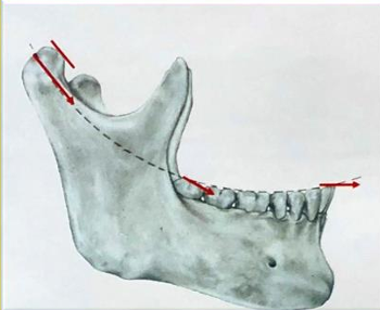 <p>-begins at the tip of the cuspid and touches the tips of all the posterior</p>