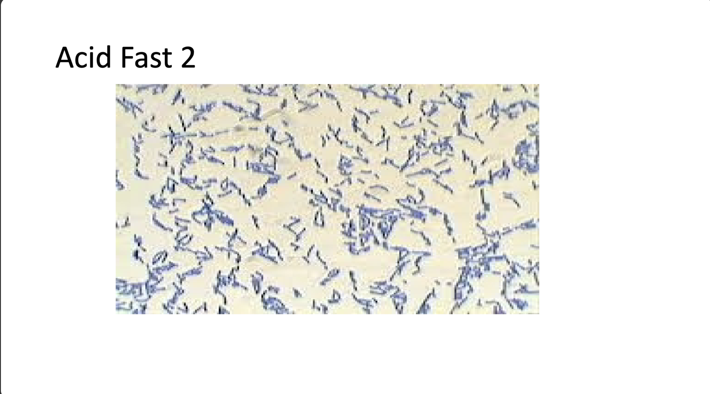<p>positive/negative and morphology</p>