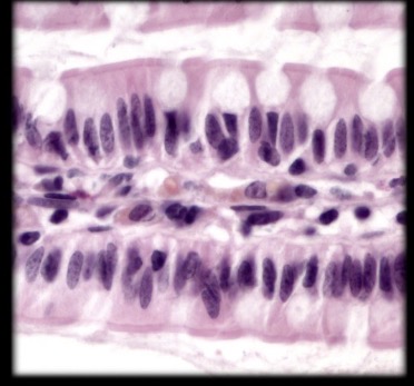 <p>What is the type tissue in this image?</p>