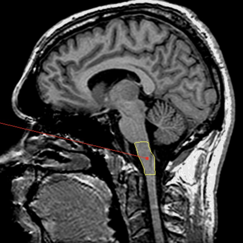 <p>What is the area highlighted called?</p>